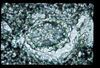 ap1401_15_17