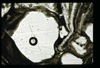 ap1601_14_14